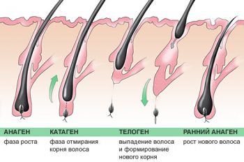 алопеция у детей