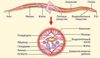 аскаридоз у детей