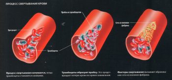 Антикоагулянты прямого действия: показания и противопоказания. Обзор средств