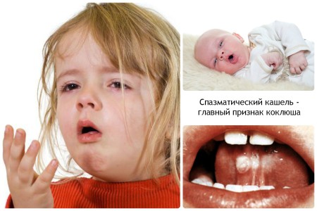 Сыпь у детей симптомы и лечение инкубационный период