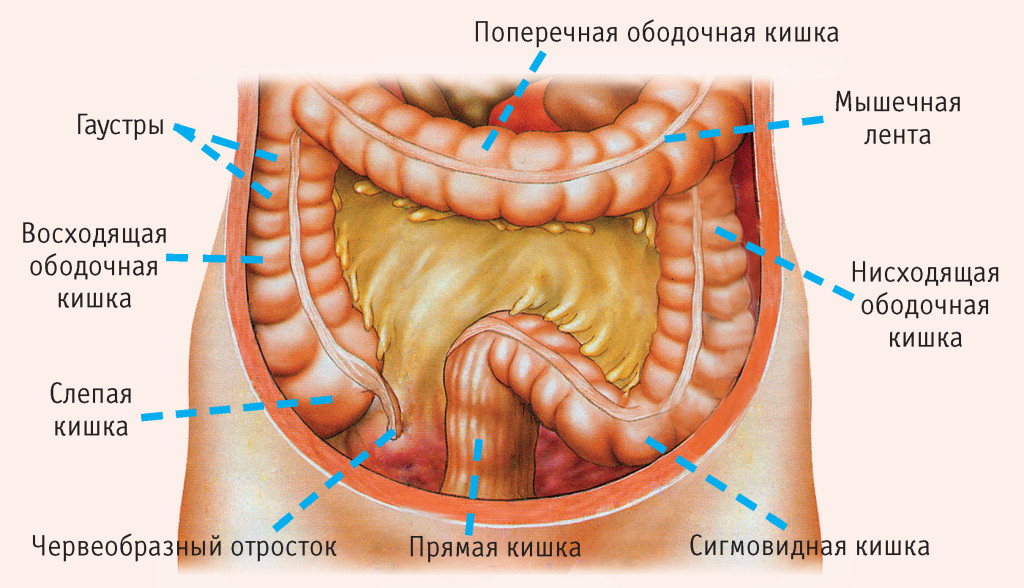 Лечение дисплазии суставов у новорожденных