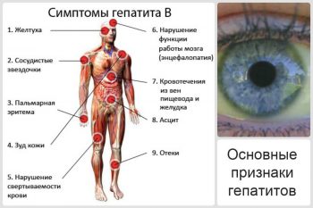 Хронический гепатит у детей: симптомы и лечение