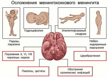 Менингококковая инфекция у детей: симптомы, лечение и профилактика