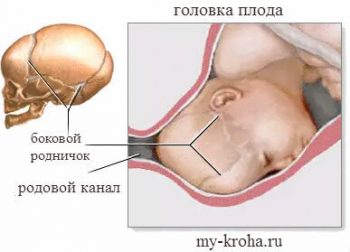 Родничок у ребенка: ответы на вопросы родителей