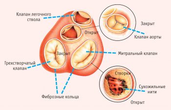 Митральные пороки сердца: диагностика и лечение