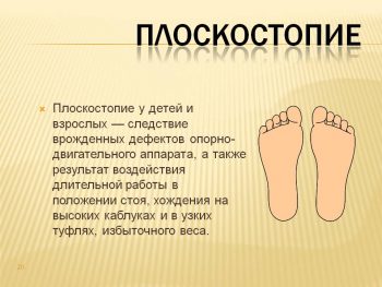 Плоскостопие у детей: причины возникновения, лечение и профилактика