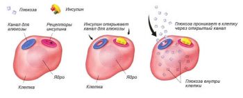 Сахарный диабет у детей