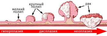 мужские болезни