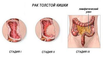 мужские болезни