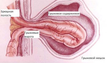 мужские болезни