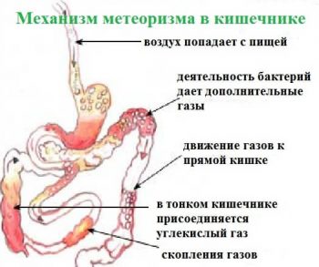 метеоризм у детей