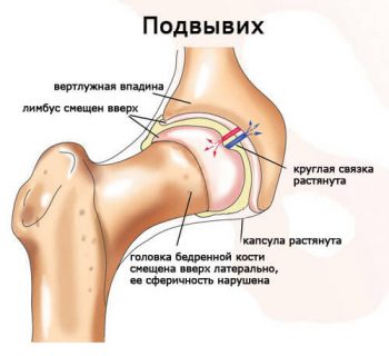 ортопедические проблемы у детей до 3 лет