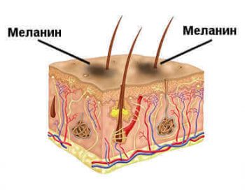 нарушения пигментации кожи