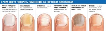 Ногти слоятся и ломаются