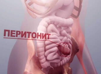 Мартина штоссель болеет анорексией фото