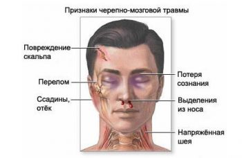 Внутричерепные гематомы: причины, симптомы, методы диагностики и лечения, реабилитация и прогнозы