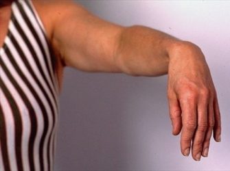 Как быстрее всего вылечить герпес на губах