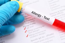 Тест на аллергены (аллергопробы): методики, показания
