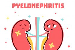 Острый пиелонефрит: симптомы, диагностика, лечение