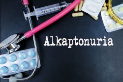 Алкаптонурия: симптомы, диагностика, лечение