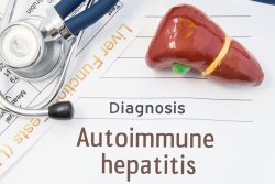 Аутоиммунный гепатит: симптомы, тактика лечения