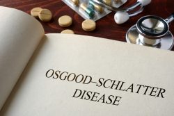 Болезнь Осгуда-Шлаттера у подростков: причины, симтомы, лечение