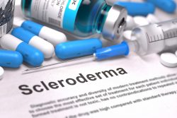 Очаговая склеродермия: причины, симптомы, лечение