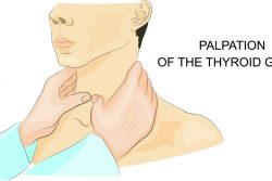 Пальпация щитовидной железы — зачем ее проводят
