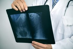 Рентгеноскопия желудка: зачем и как проводят