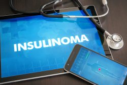Инсулинома: симптомы, лечение
