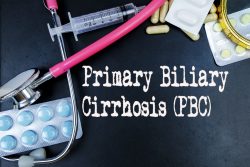 Первичный билиарный цирроз печени: почему возникает и как лечить