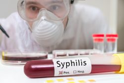 Как лечить сифилис