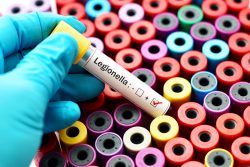 Болезнь легионеров (легионеллез): причины, симптомы и лечение