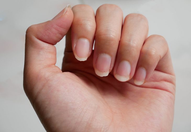 Как вылечить ногти ломаются слоятся thumbnail