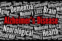 Болезнь Альцгеймера: профилактика и лечение