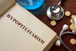 Гипопитуитаризм: симптомы и лечение
