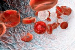 Основные признаки анемии и как поднять уровень гемоглобина в крови