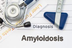 Амилоидоз – симптомы, лечение