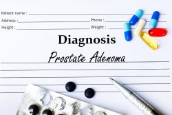 Аденома предстательной железы —  симптомы и лечение