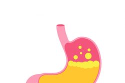 Как определить кислотность желудка: интрагастральная и внутрипищеводная рН-метрия