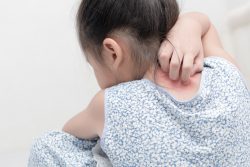Псориаз у детей: симптомы и лечение