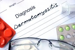 Дерматомиозит: симптомы и лечение