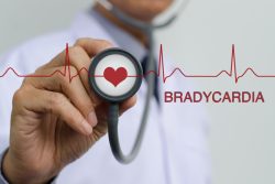 Брадикардия: причины и симптомы. Рекомендации кардиолога
