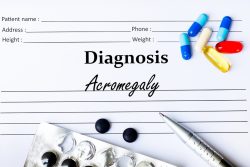 Акромегалия: причины, симптомы и лечение