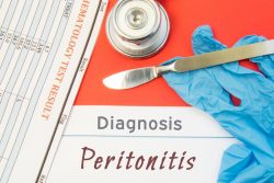 Перитонит: симптомы у взрослых, лечение