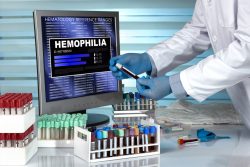 Гемофилия: что это за болезнь и что о ней нужно знать?