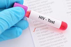 Современные методы диагностики ВИЧ-инфекции
