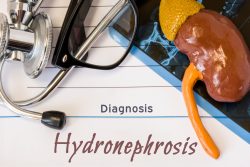 Причины, симптомы и лечение гидронефроза