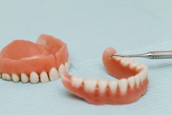 Покрывной зубной протез – что это?
