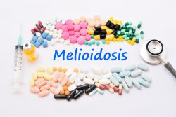 Мелиоидоз: причины, симптомы, лечение